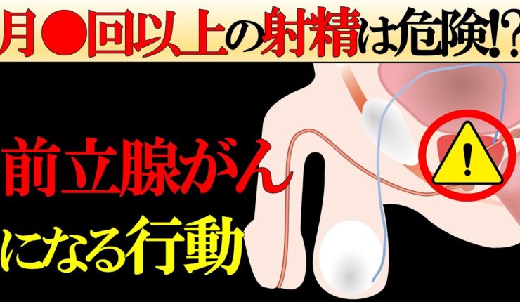 前立腺がんが急増している「超意外な理由」【症状から予防まで徹底解説】
