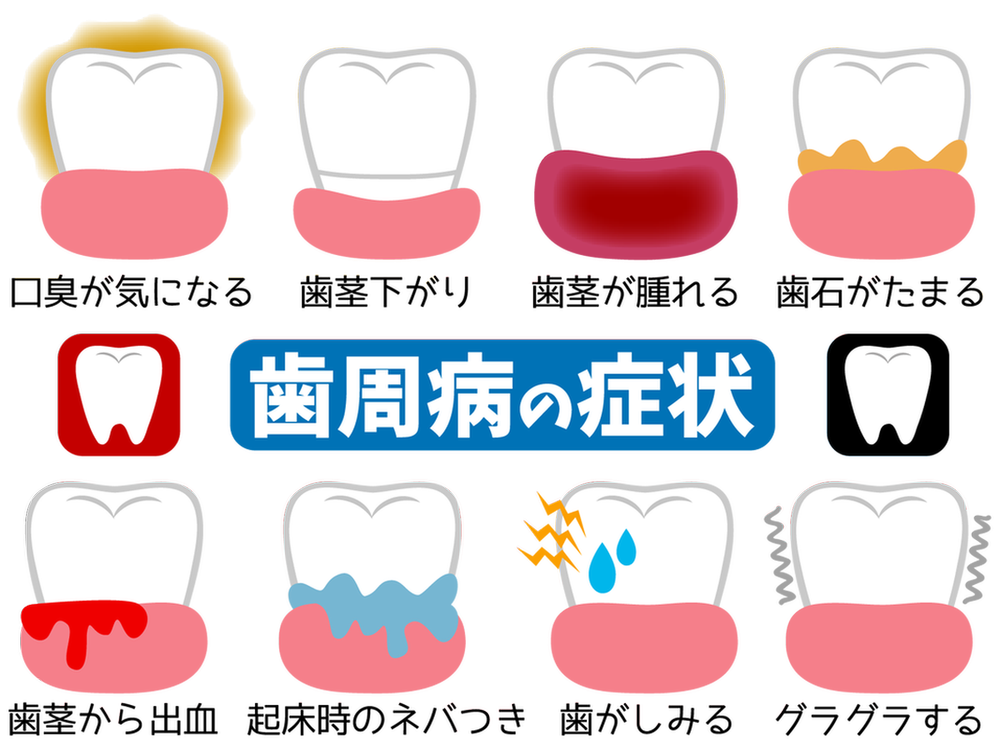 近年、歯周病が増えている原因は？