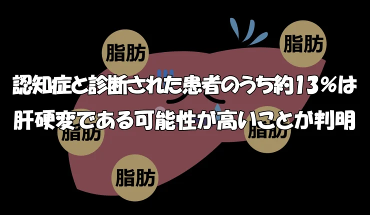 認知症と診断された患者のうち約13％は肝硬変である可能性が高いことが判明